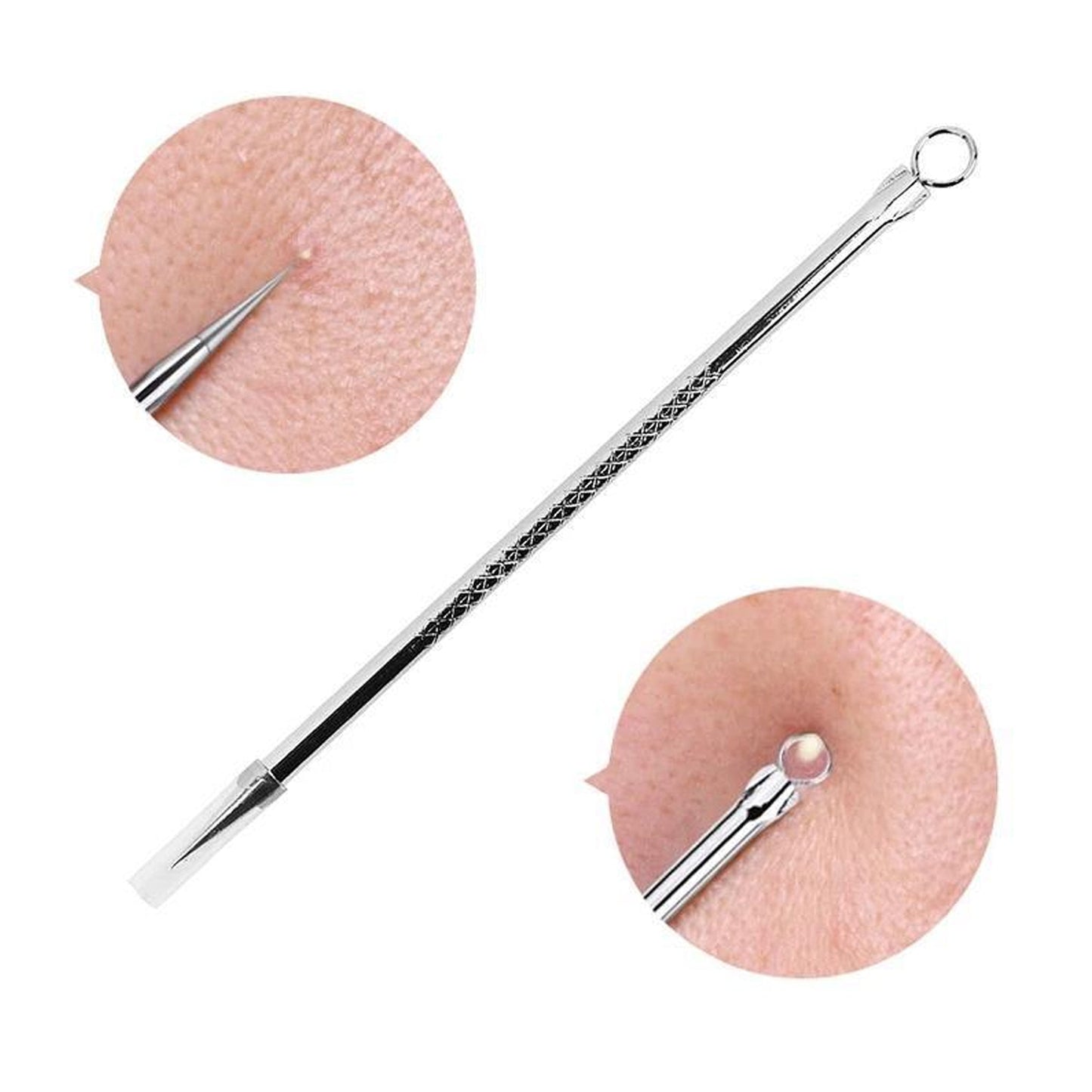 Pimple & Blackhead Extractor